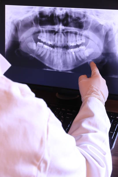 Best Emergency Treatment for Dental Infections or Abscesses in Babson Park, FL
